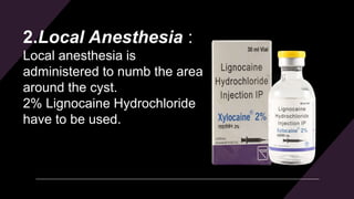 2.Local Anesthesia :
Local anesthesia is
administered to numb the area
around the cyst.
2% Lignocaine Hydrochloride
have to be used.
 