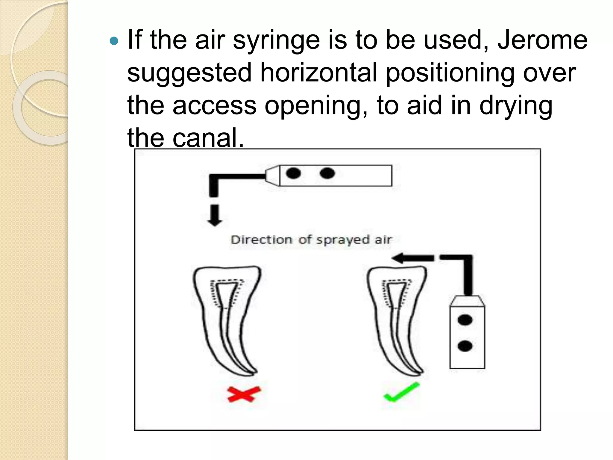  If the air syringe is to be used, Jerome
suggested horizontal positioning over
the access opening, to aid in drying
the canal.
 