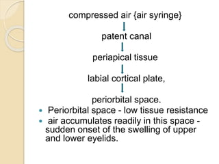 compressed air {air syringe}
patent canal
periapical tissue
labial cortical plate,
periorbital space.
 Periorbital space - low tissue resistance
 air accumulates readily in this space -
sudden onset of the swelling of upper
and lower eyelids.
 