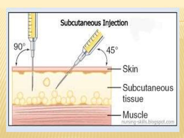 Subcutaneous injection