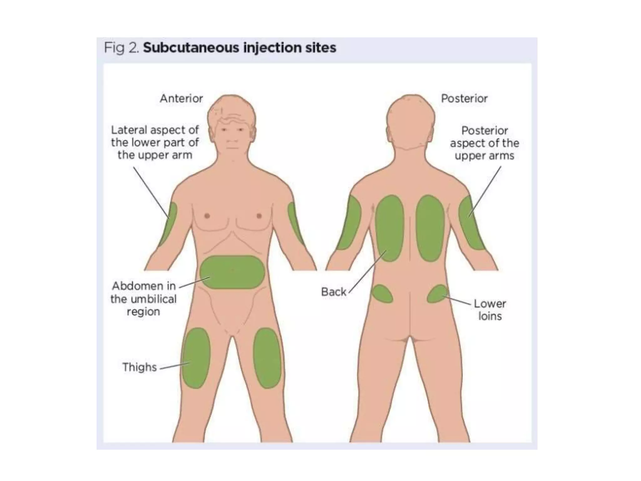 subcutaneous-injection-pptx
