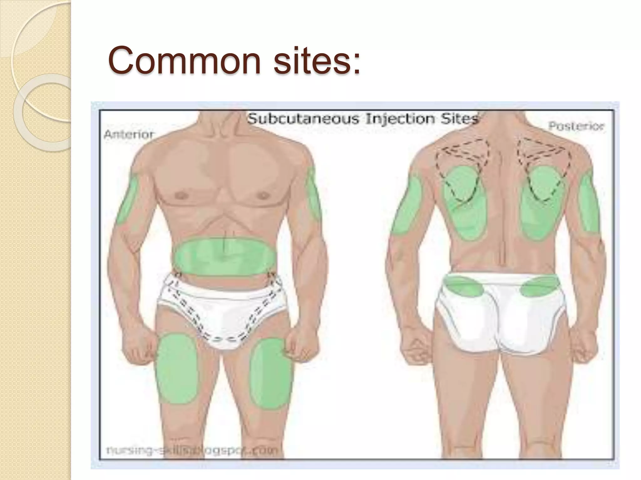 Common sites:
 