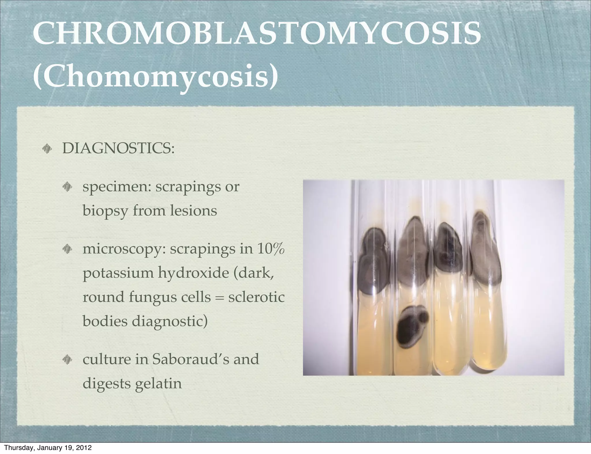 CHROMOBLASTOMYCOSIS
        (Chomomycosis)

                 DIAGNOSTICS:

                       specimen: scrapings or
                       biopsy from lesions

                       microscopy: scrapings in 10%
                       potassium hydroxide (dark,
                       round fungus cells = sclerotic
                       bodies diagnostic)

                       culture in Saboraud’s and
                       digests gelatin


Thursday, January 19, 2012
 