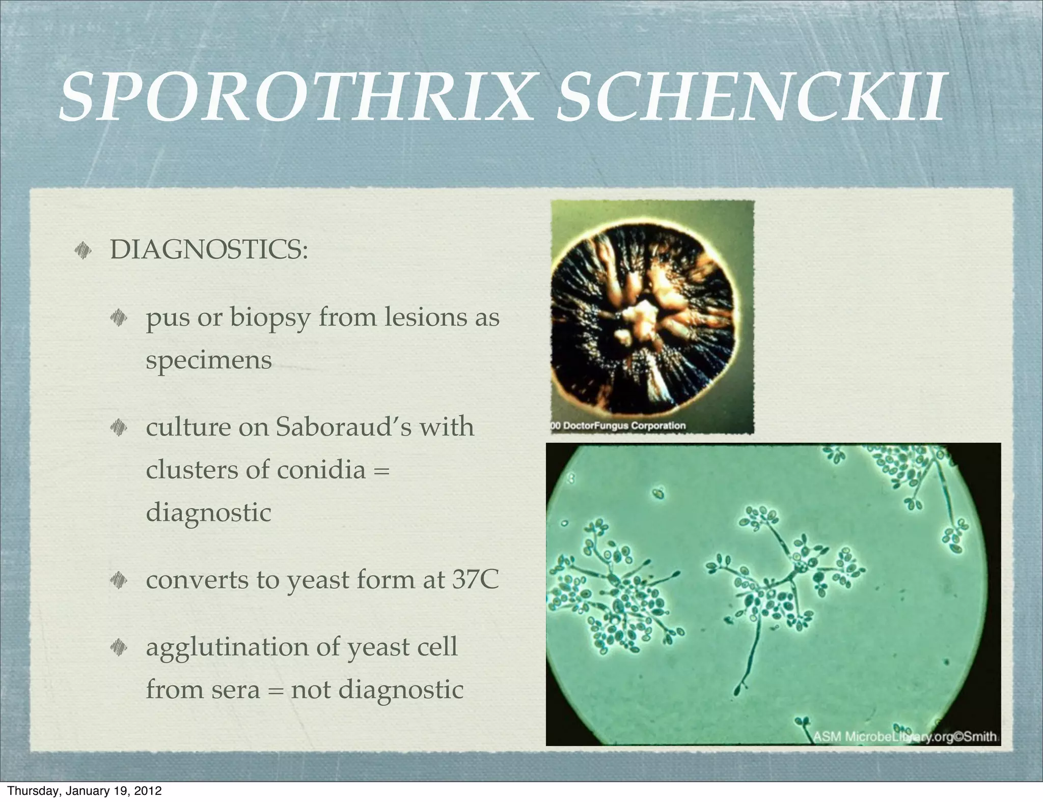 SPOROTHRIX SCHENCKII
                 DIAGNOSTICS:

                       pus or biopsy from lesions as
                       specimens

                       culture on Saboraud’s with
                       clusters of conidia =
                       diagnostic

                       converts to yeast form at 37C

                       agglutination of yeast cell
                       from sera = not diagnostic


Thursday, January 19, 2012
 
