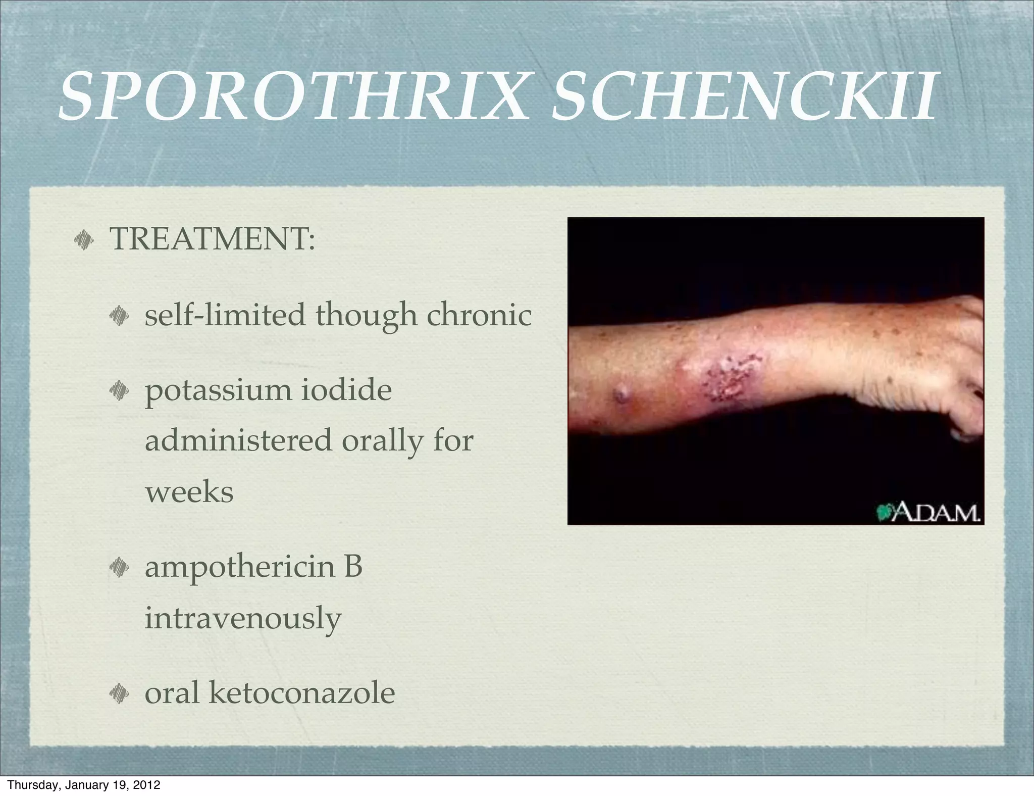SPOROTHRIX SCHENCKII
                 TREATMENT:

                       self-limited though chronic

                       potassium iodide
                       administered orally for
                       weeks

                       ampothericin B
                       intravenously

                       oral ketoconazole

Thursday, January 19, 2012
 