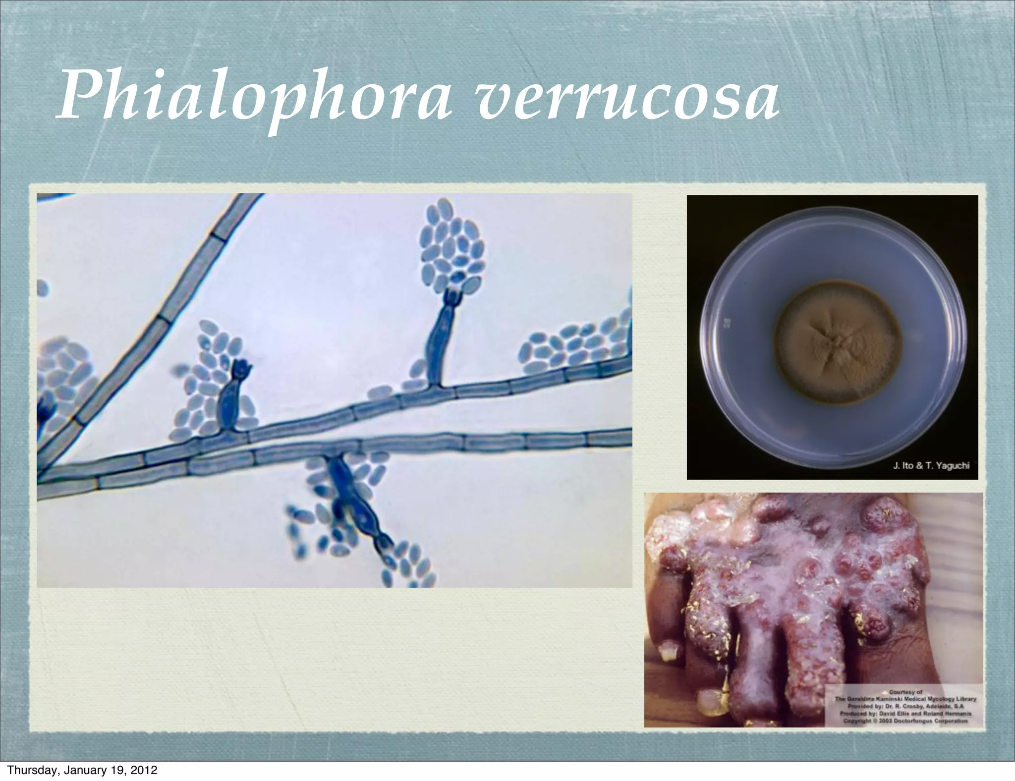 Phialophora verrucosa




Thursday, January 19, 2012
 