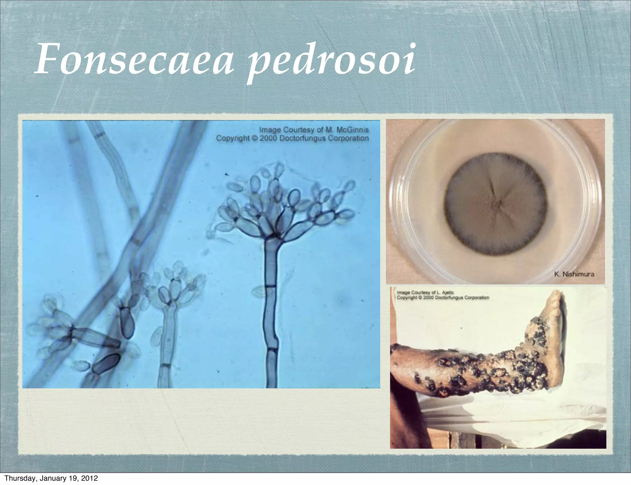 Fonsecaea pedrosoi




Thursday, January 19, 2012
 