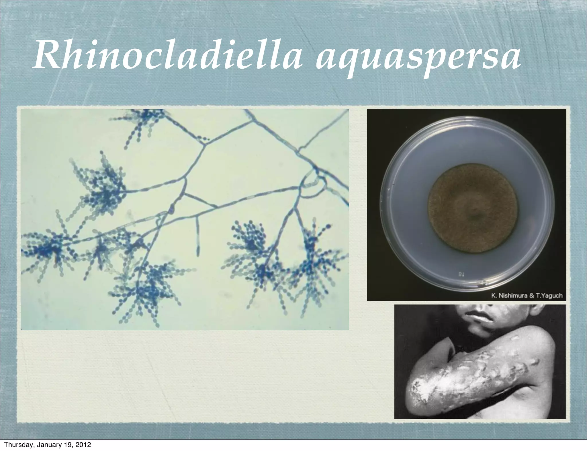 Rhinocladiella aquaspersa




Thursday, January 19, 2012
 