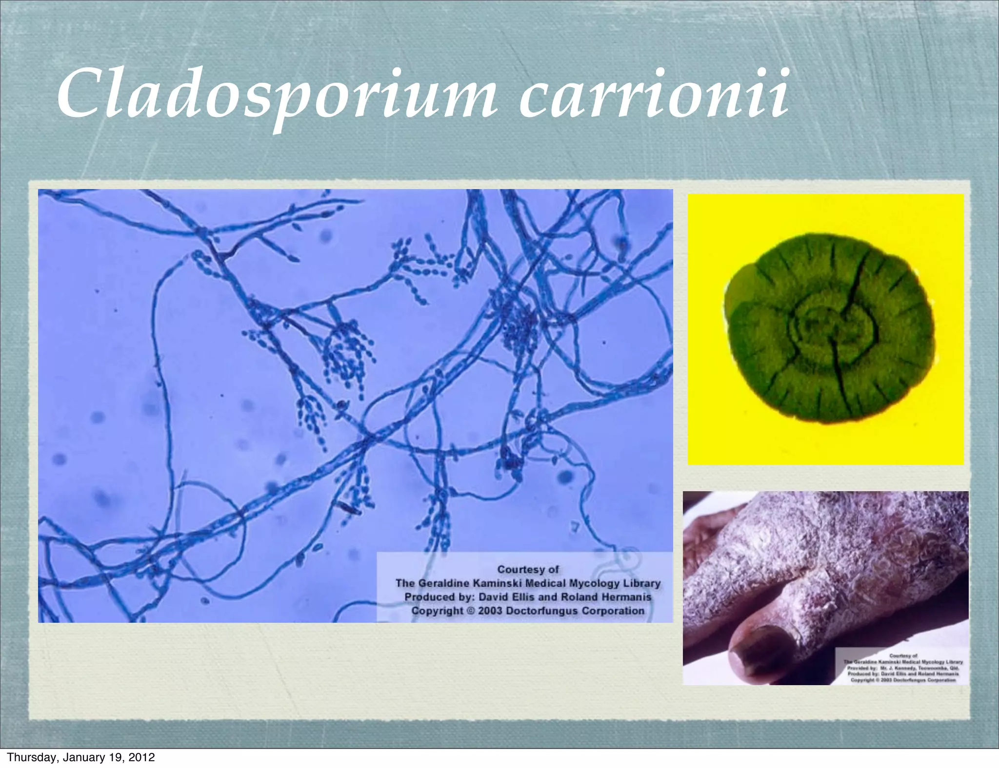 Cladosporium carrionii




Thursday, January 19, 2012
 
