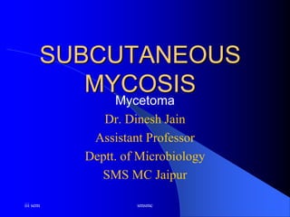 iii sem smsmc
SUBCUTANEOUS
MYCOSIS
Mycetoma
Dr. Dinesh Jain
Assistant Professor
Deptt. of Microbiology
SMS MC Jaipur
 