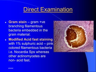 smsmc
Direct Examination
 Gram stain – gram +ve
branching filamentous
bacteria embedded in the
grain material.
 Modified Acid fast staining
with 1% sulphuric acid – pink
colored filamentous bacteria
i.e. Nocardia Sps whereas
other actinomycetes are
non- acid fast.
 