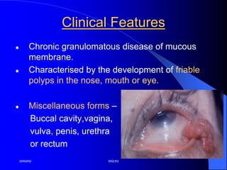 smsmc micro
Clinical Features
 Chronic granulomatous disease of mucous
membrane.
 Characterised by the development of friable
polyps in the nose, mouth or eye.
 Miscellaneous forms –
Buccal cavity,vagina,
vulva, penis, urethra
or rectum
 