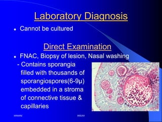 smsmc micro
Laboratory Diagnosis
 Cannot be cultured
Direct Examination
 FNAC, Biopsy of lesion, Nasal washing
- Contains sporangia
filled with thousands of
sporangiospores(6-9µ)
embedded in a stroma
of connective tissue &
capillaries
 