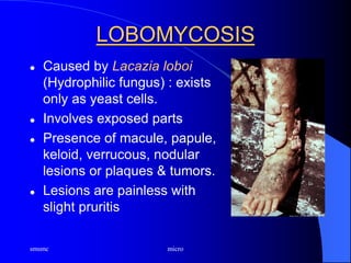 smsmc micro
LOBOMYCOSIS
 Caused by Lacazia loboi
(Hydrophilic fungus) : exists
only as yeast cells.
 Involves exposed parts
 Presence of macule, papule,
keloid, verrucous, nodular
lesions or plaques & tumors.
 Lesions are painless with
slight pruritis
 
