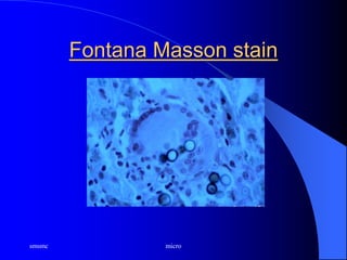 smsmc micro
Fontana Masson stain
 