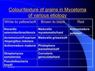 16/12/07
Colour/texture of grains in Mycetoma
of various etiology
White to yellow/soft Brown to black Red
Nocardia
asteroides/brasiliensis
Madurella
mycetomatis/hard
Actinomadura
pelletieri
Acremonium/Fusarium
/Aspergillus nidulans
Madurella grisea/soft
Actinomadura madurai Phialophora
jeanselmei/soft
Streptomyces
somaliensis
Curvularia
geniculata/hard
Pseudollescheria
boydii
 