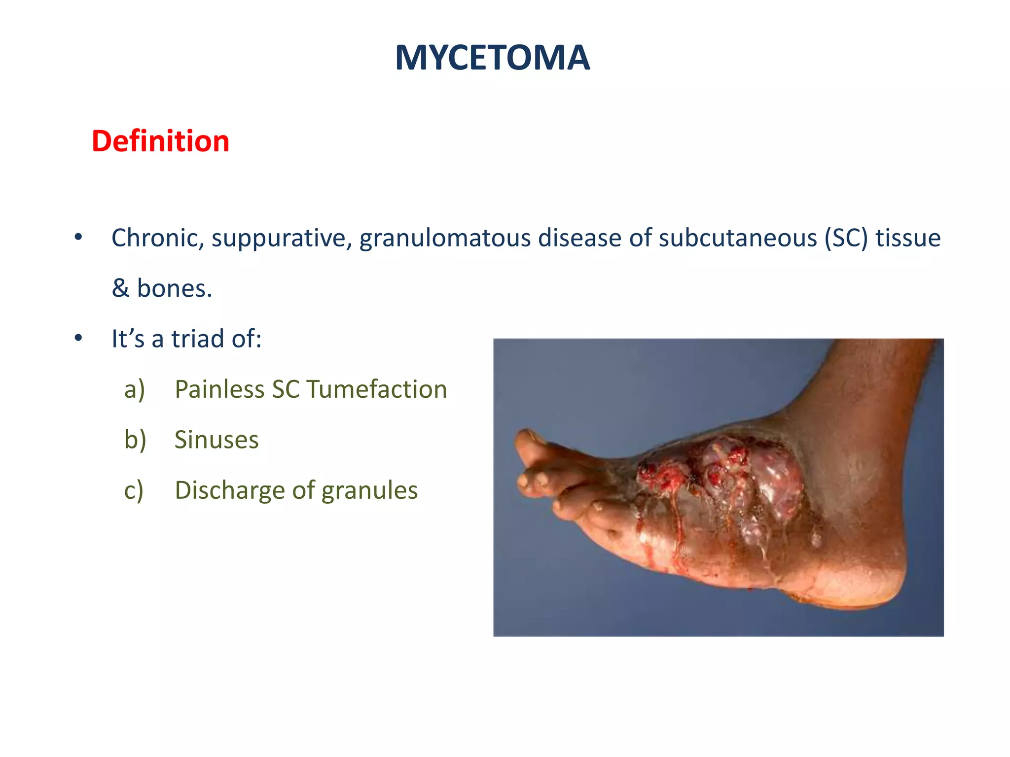 MYCETOMA
Definition
• Chronic, suppurative, granulomatous disease of subcutaneous (SC) tissue
& bones.
• It’s a triad of:
a) Painless SC Tumefaction
b) Sinuses
c) Discharge of granules
 
