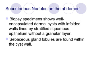 Subcutaneus Nodules on the abdomen
Biopsy specimens shows well-
encapsulated dermal cysts with infolded
walls lined by stratified squamous
epithelium without a granular layer.
Sebaceous gland lobules are found within
the cyst wall.
 