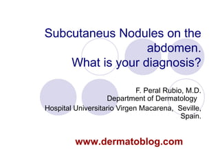 Subcutaneus Nodules on the
abdomen.
What is your diagnosis?
F. Peral Rubio, M.D.
Department of Dermatology
Hospital Universitario Virgen Macarena, Seville,
Spain.
www.dermatoblog.com
 