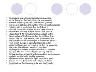  hospital with asymptomatic subcutaneous nodules
 on her forearms. She first noticed the subcutaneous
 nodules 10 years previously, and they had gradually
 increased in both size and number. They were not associated
 with any pain or tenderness. Her family history
 and past clinical history were unremarkable. Physical
 examination revealed multiple, mobile, well-defined,
 elastic-hard, 5–10 mm subcutaneous nodules on the
 flexor surface of the forearms; 8 on the right and 3 on
 the left (Fig. 1). There were no other lesions except for
 the forearms and no nail changes. Clinically, the lesions
 were initially thought to be multiple lipomas and an
 excisional biopsy was performed to confirm the suspected
 diagnosis. Upon biopsy, a well-circumscribed
 ovoid cyst was isolated in the superficial subcutaneous
 fat layer. The cyst contained yellow creamy material.
 Biopsy specimen showed a well-encapsulated subcutaneous
 cyst with infolded walls lined by squamous
 epithelium without a granular layer. Sebaceous gland
 lobules are found within the cyst wall (Fig. 2). From
 these findings, the diagnosis of SM was finally made.
 