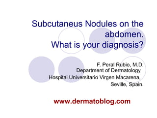 Subcutaneus Nodules on the
abdomen.
What is your diagnosis?
F. Peral Rubio, M.D.
Department of Dermatology
Hospital Universitario Virgen Macarena,
Seville, Spain.
www.dermatoblog.com
 