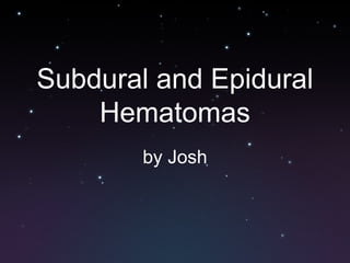 Subdural and Epidural Hematomas by Josh 