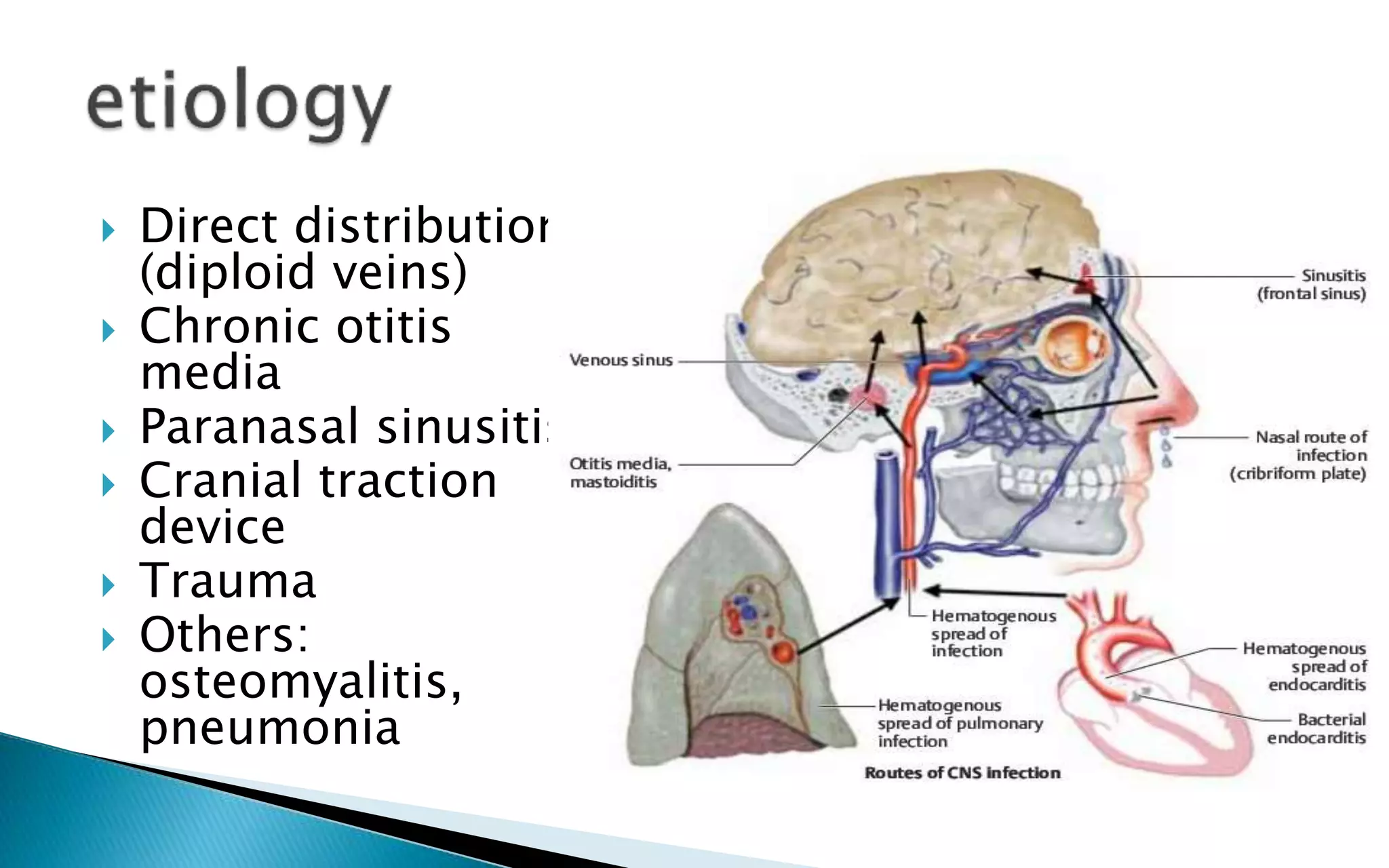  Direct distribution
(diploid veins)
Chronic otitis
media
Paranasal sinusitis
Cranial traction
device
Trauma
Others:
osteomyalitis,
pneumonia