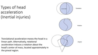 Accelaration Injries Subdural Hematoma | PPTX