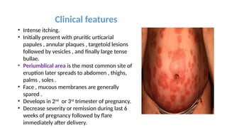 Targetoid Features SUBEPIDERMAL BLISTERING DISORDERS presentation | PPTX