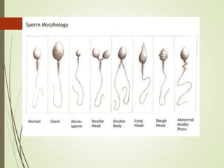 Subfertility | PPTX