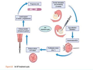 Male and Female Subfertility | PPTX