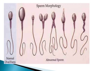 Subfertility | PPTX