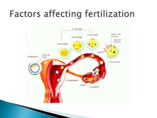 Subfertility | PPTX
