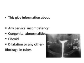 Subfertility.pptx