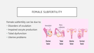 Subfertility | PPTX
