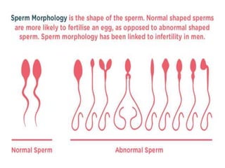 Subfertility / OBS & GYN ( updated ) | PPTX