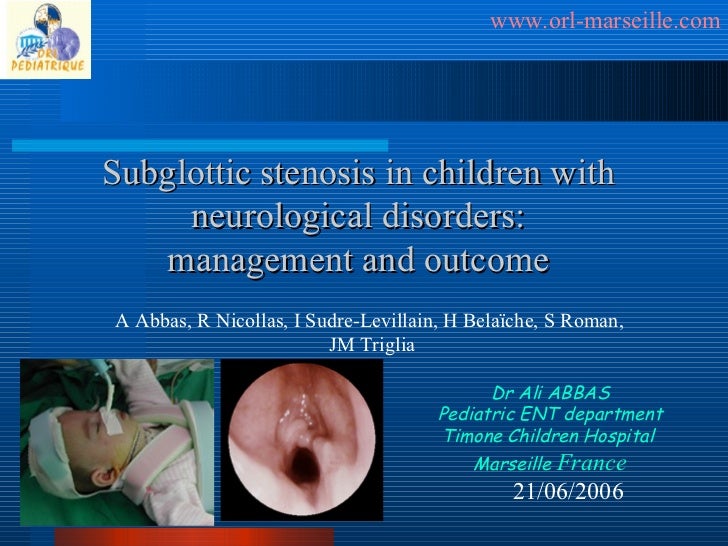 Subglottic Stenosis in children