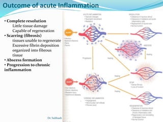 Mechanism of inflammation | PPT