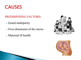 Subinvolution of the uterus