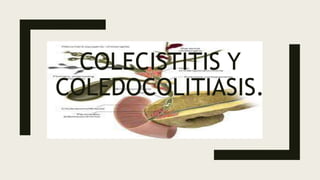 COLECISTITIS Y
COLEDOCOLITIASIS.
.
 