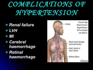 COMPLICATIONS OF HYPERTENSION Renal failure LVH MI Cerebral haemorrhage Retinal haemorrhage 