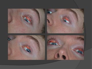 Subject 1 - Contact Sheets