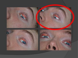 Subject 1 - Contact Sheets