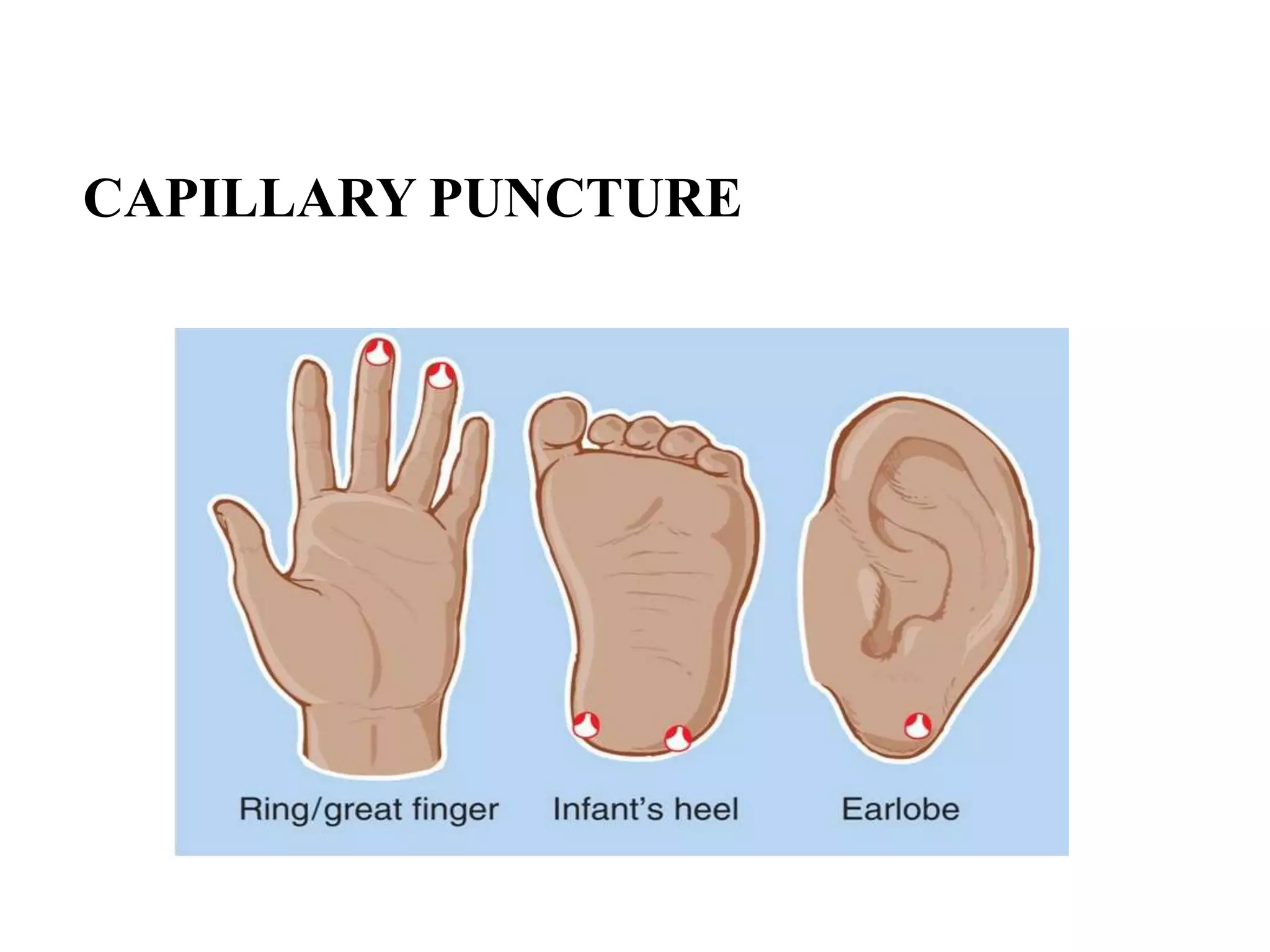 CAPILLARY PUNCTURE
 