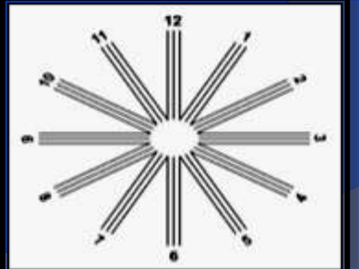 Subjective refraction by optom praveen