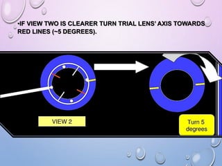 •IF VIEW TWO IS CLEARER TURN TRIAL LENS’ AXIS TOWARDS
RED LINES (~5 DEGREES).
 