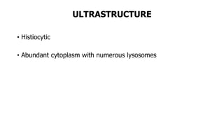 ULTRASTRUCTURE
• Histiocytic
• Abundant cytoplasm with numerous lysosomes
 