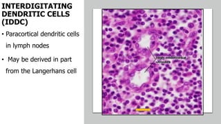 INTERDIGITATING
DENDRITIC CELLS
(IDDC)
• Paracortical dendritic cells
in lymph nodes
• May be derived in part
from the Langerhans cell
 