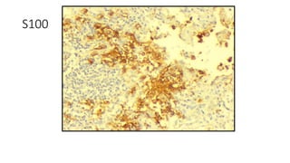 S100
 