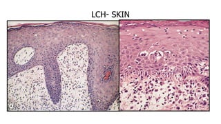 LCH- SKIN
 